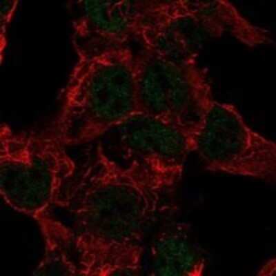 Immunocytochemistry/ Immunofluorescence: SART3 Antibody [NBP3-17928]