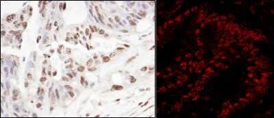 Immunohistochemistry: SART3 Antibody [NB100-74648]