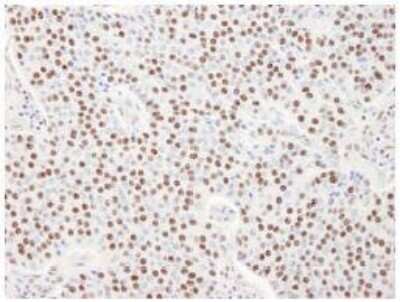 Immunohistochemistry-Paraffin: SART3 Antibody [NB100-74648]