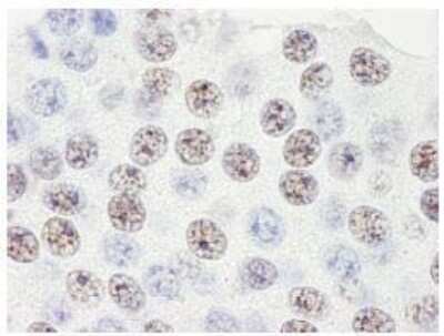 Immunohistochemistry-Paraffin: SART3 Antibody [NB100-74648]