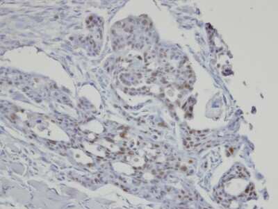 Immunohistochemistry-Paraffin: SART3 Antibody [NBP1-31487]