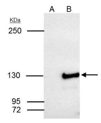 Immunoprecipitation: SART3 Antibody [NBP1-31487]