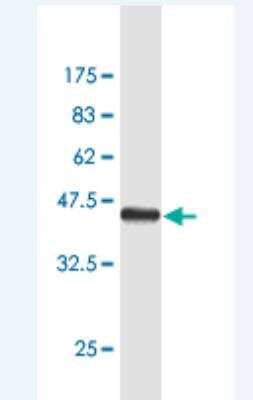 Western Blot: SASH1 Antibody (X1) [H00023328-M02]