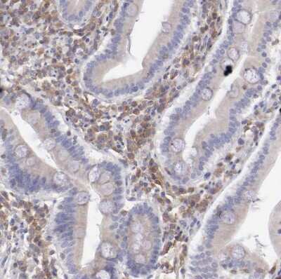 Immunohistochemistry-Paraffin: SASH3 Antibody [NBP1-92364]