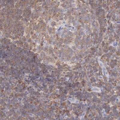 Immunohistochemistry-Paraffin: SASH3 Antibody [NBP1-92364]