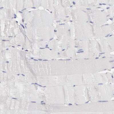 Immunohistochemistry-Paraffin: SASH3 Antibody [NBP1-92364]