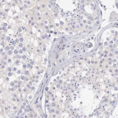 Immunohistochemistry-Paraffin: SASH3 Antibody [NBP1-92364]