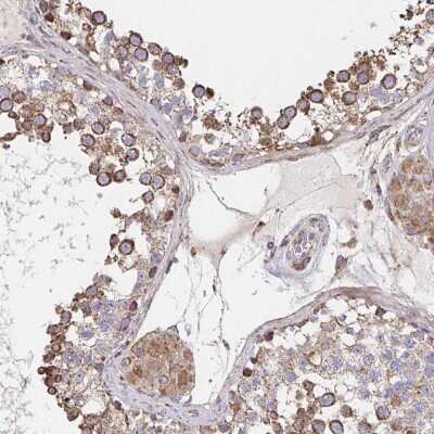 Immunohistochemistry-Paraffin: SAT1 Antibody [NBP2-37947]