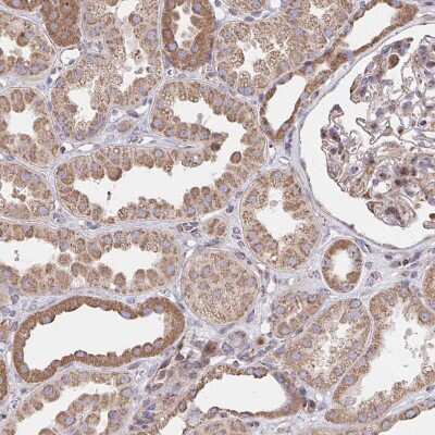 Immunohistochemistry-Paraffin: SAT1 Antibody [NBP2-37947]