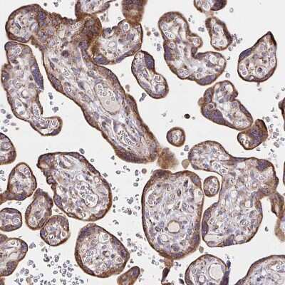 Immunohistochemistry-Paraffin: SAT1 Antibody [NBP2-37947]