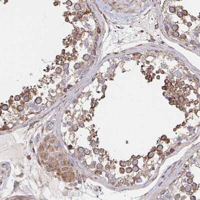 Immunohistochemistry-Paraffin: SAT1 Antibody [NBP2-37947]