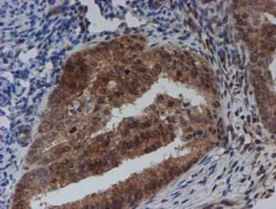Immunohistochemistry-Paraffin: SAT2 Antibody (OTI1C9) [NBP2-01998]