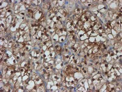 Immunohistochemistry-Paraffin: SAT2 Antibody (OTI1C9) [NBP2-01998]
