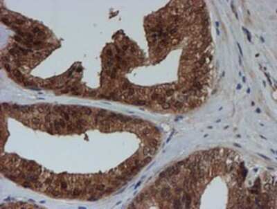 Immunohistochemistry-Paraffin: SAT2 Antibody (OTI1C9) [NBP2-01998]