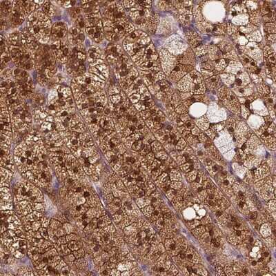 Immunohistochemistry-Paraffin: SAT2 Antibody [NBP1-80722]