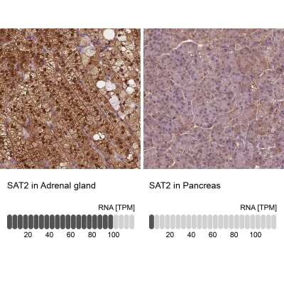 Immunohistochemistry-Paraffin: SAT2 Antibody [NBP1-80722]