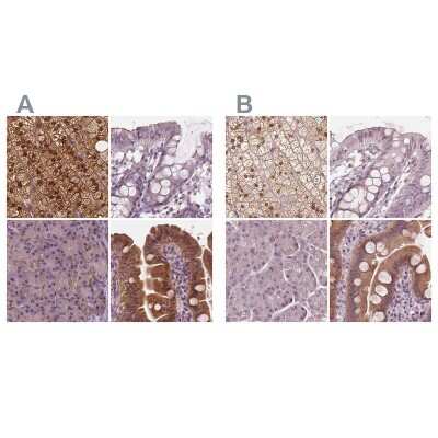 Immunohistochemistry-Paraffin: SAT2 Antibody [NBP1-80722]