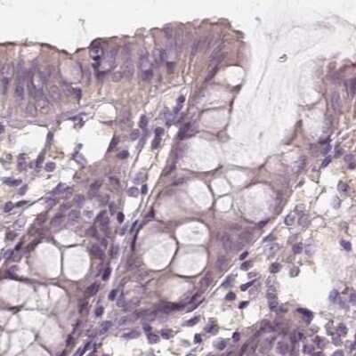 Immunohistochemistry-Paraffin: SAT2 Antibody [NBP1-80722]