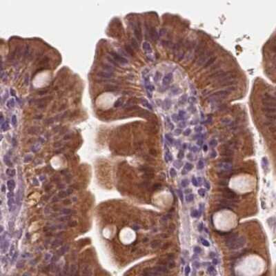 Immunohistochemistry-Paraffin: SAT2 Antibody [NBP1-80722]