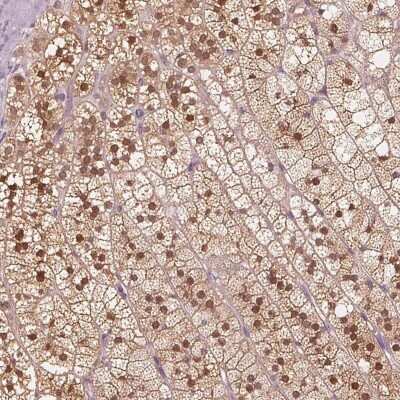 Immunohistochemistry-Paraffin: SAT2 Antibody [NBP2-49244]