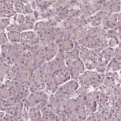 Immunohistochemistry-Paraffin: SAT2 Antibody [NBP2-49244]