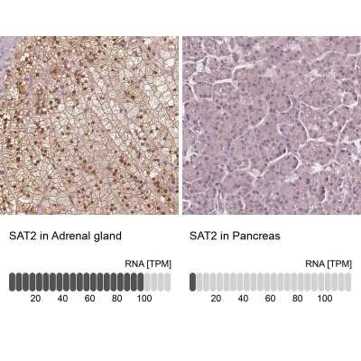 Immunohistochemistry-Paraffin: SAT2 Antibody [NBP2-49244]