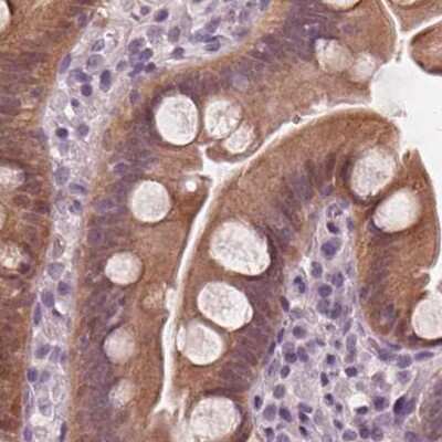 Immunohistochemistry-Paraffin: SAT2 Antibody [NBP2-49244]