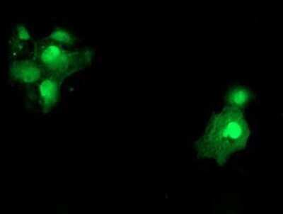 Immunocytochemistry/ Immunofluorescence: SAT2 Antibody (OTI1C9) - Azide and BSA Free [NBP2-73990]