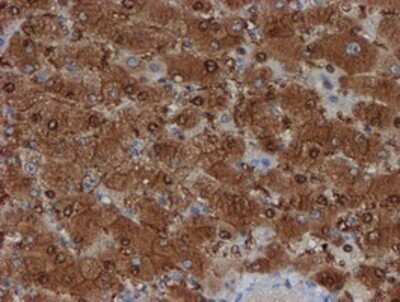 Immunohistochemistry: SAT2 Antibody (OTI1C9) - Azide and BSA Free [NBP2-73990]