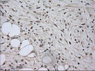 Immunohistochemistry-Paraffin: SATB1 Antibody (OTI13D6) [NBP1-47950]