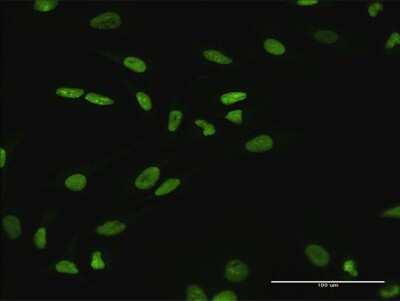 Immunocytochemistry/ Immunofluorescence: SATB1 Antibody [H00006304-B01P]