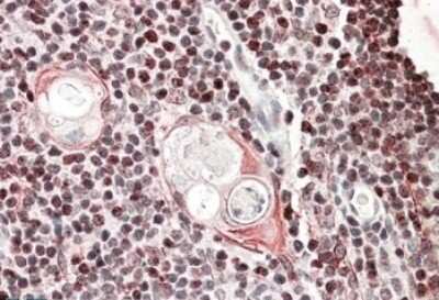 Immunohistochemistry-Paraffin: SATB1 Antibody [NBP1-51960]