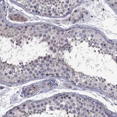 Immunohistochemistry-Paraffin: SATB1 Antibody [NBP3-17001]