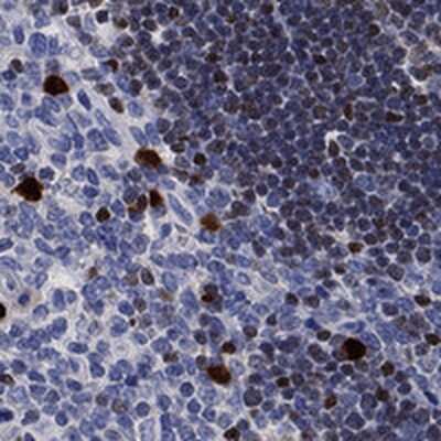 Immunohistochemistry-Paraffin: SATB1 Antibody [NBP3-17001]