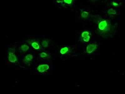 Immunocytochemistry/ Immunofluorescence: SATB1 Antibody (OTI13D6) - Azide and BSA Free [NBP2-73991]