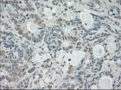 Immunohistochemistry: SATB1 Antibody (OTI13D6) - Azide and BSA Free [NBP2-73991]