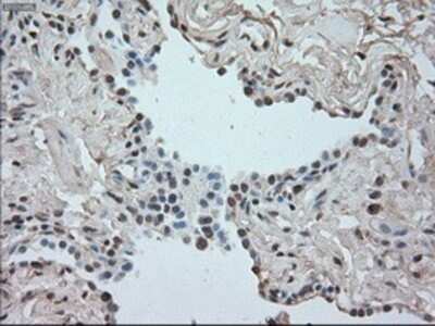 Immunohistochemistry: SATB1 Antibody (OTI13D6) - Azide and BSA Free [NBP2-73991]