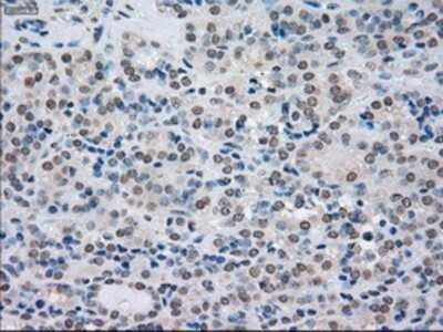 Immunohistochemistry: SATB1 Antibody (OTI13D6) - Azide and BSA Free [NBP2-73991]