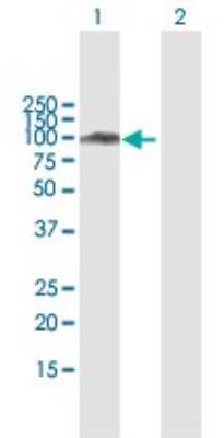 Western Blot: SATB1 Antibody [H00006304-B01P]