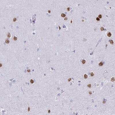 Immunohistochemistry-Paraffin: SATB2 Antibody (CL0276) [NBP2-52900]