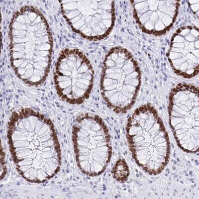 Immunohistochemistry-Paraffin: SATB2 Antibody (CL0276) [NBP2-52900]