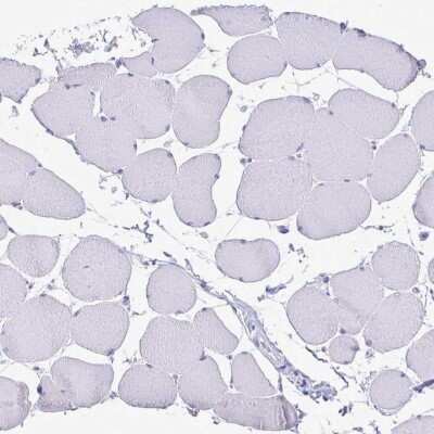 Immunohistochemistry-Paraffin: SATB2 Antibody (CL0276) [NBP2-52900]