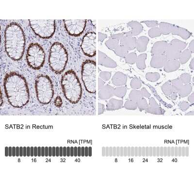 Immunohistochemistry-Paraffin: SATB2 Antibody (CL0276) [NBP2-52900]