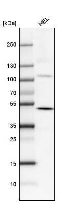 Western Blot: SATB2 Antibody (CL0276) [NBP2-52900]
