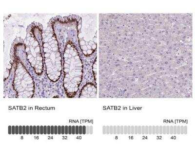 Immunohistochemistry-Paraffin: SATB2 Antibody (CL0319) [NBP2-52913]