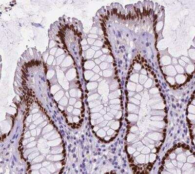 Immunohistochemistry-Paraffin: SATB2 Antibody (CL0319) [NBP2-52913]