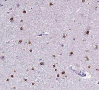 Immunohistochemistry-Paraffin: SATB2 Antibody (CL0319) [NBP2-52913]