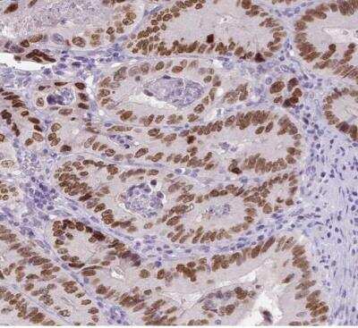 Immunohistochemistry-Paraffin: SATB2 Antibody (CL0319) [NBP2-52913]