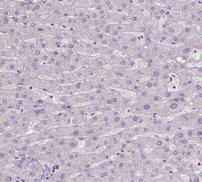 Immunohistochemistry-Paraffin: SATB2 Antibody (CL0319) [NBP2-52913]