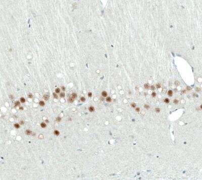 Immunohistochemistry-Paraffin: SATB2 Antibody (CL0319) [NBP2-52913]